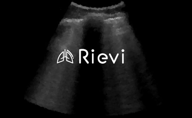 Yapay Zeka ile Akciğer Ultrasonu